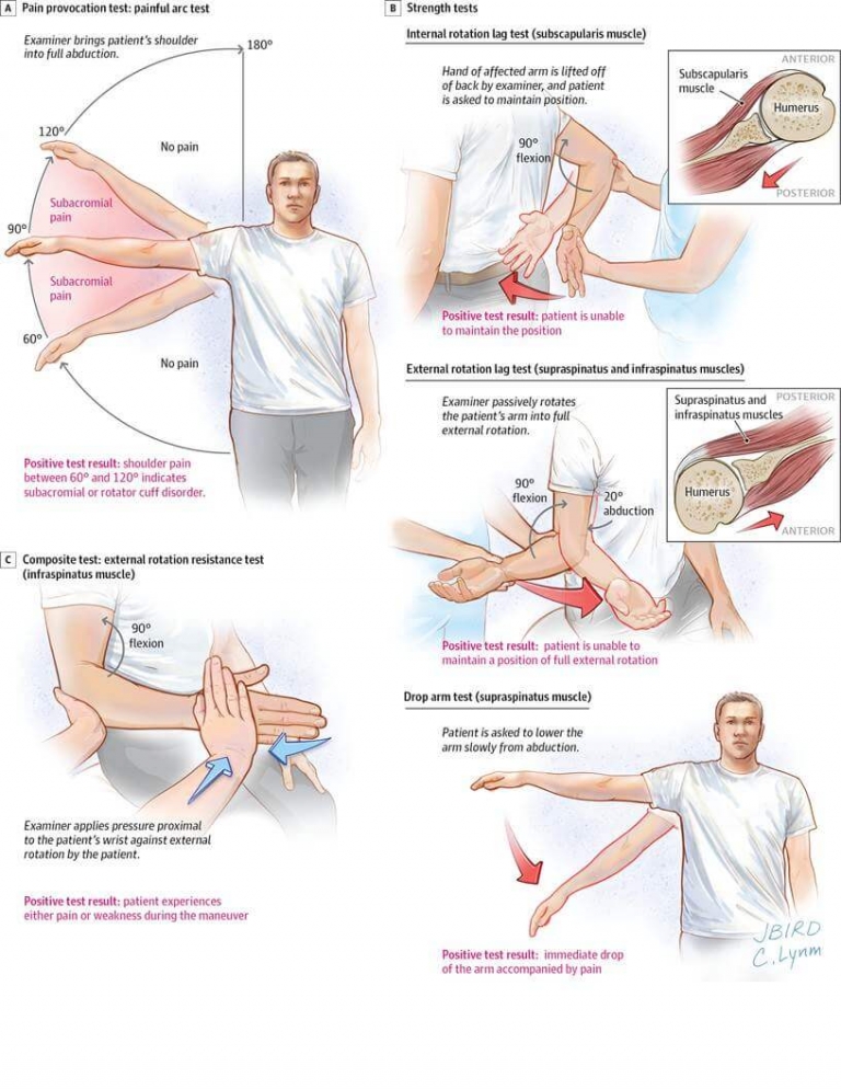 Rotator Cuff Management Series Proactivephysioknowledge