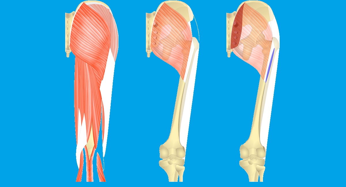Gluteus Maximus Activation Optimal position proactivephysioknowledge